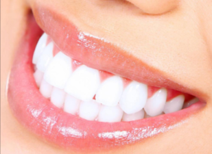 Teeth turn yellow how to do! Teeth whitening method to give you a white teeth!