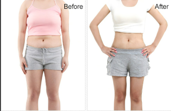 Tummy tuck revealed: The perfect belly you deserve